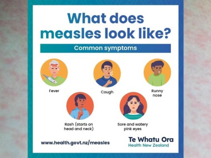 measles